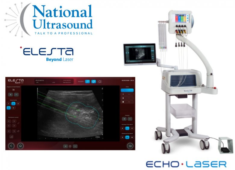 National Ultrasound Partners With Elesta to Sell Elesta EchoLaser in United States