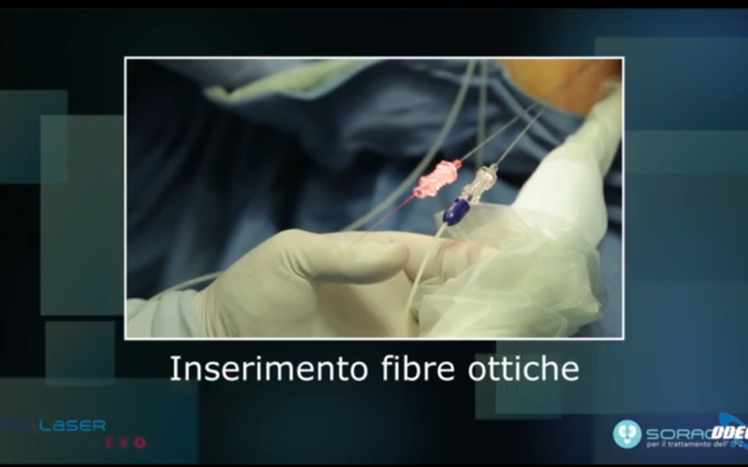 SoracteLite presentato su Odeon TV
